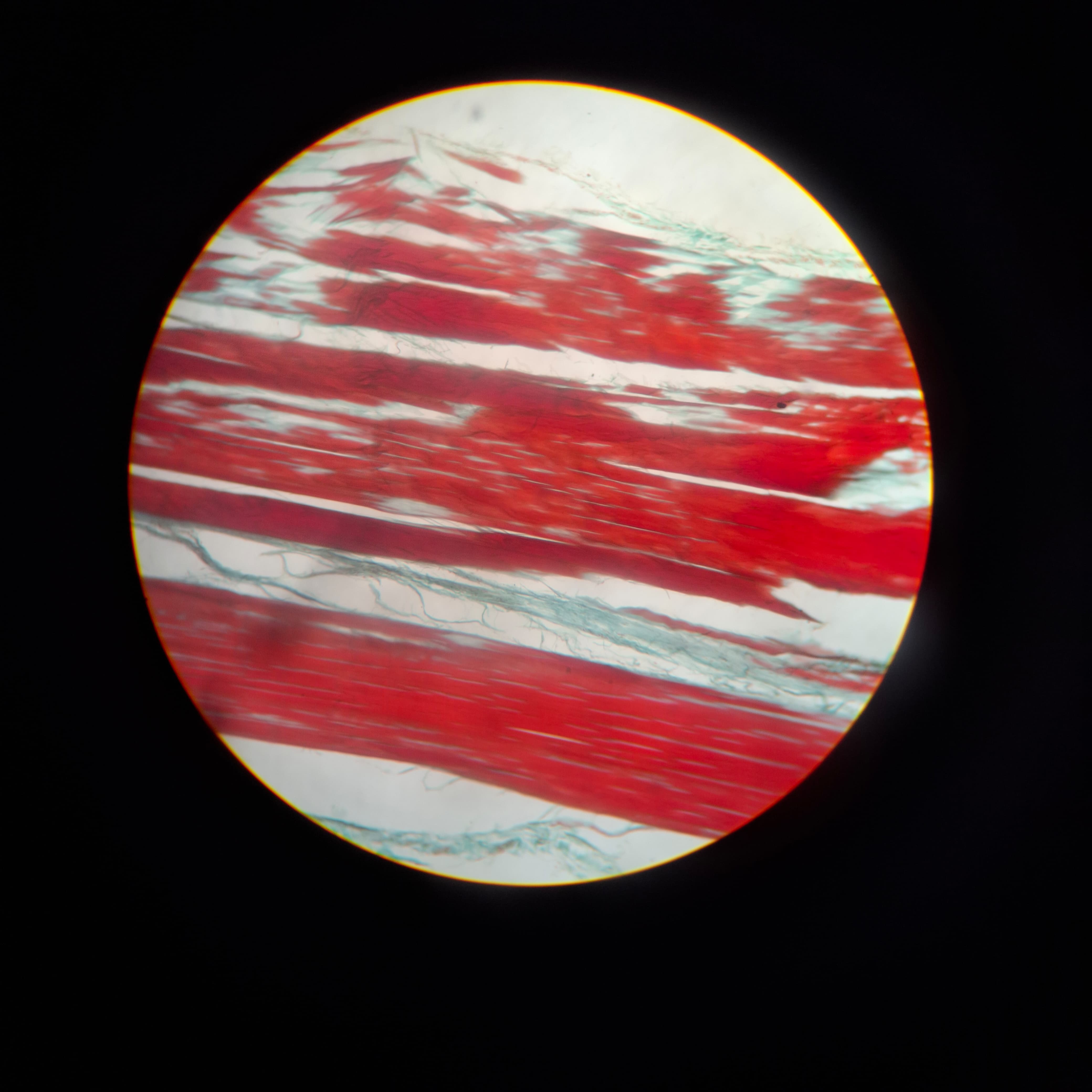 Dense Connective Tissue